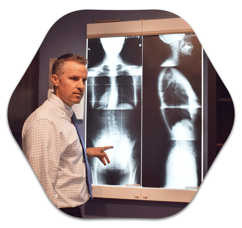Chiropractor West Salem WI Daniel Eoriatti With Xray Chiropractor West Salem WI Daniel Eoriatti With Xray