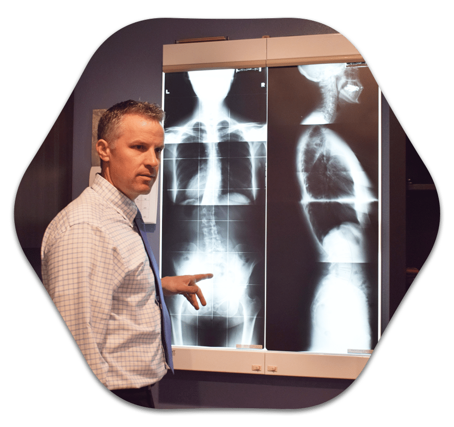 Chiropractor West Salem WI Daniel Eoriatti With Xray